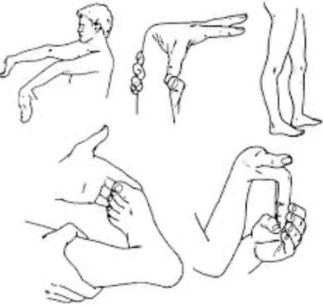 TẬP YOGA QUÁ DẺO LIỆU CÓ TỐT CHO CHẠY BỘ ĐƯỜNG DÀI?