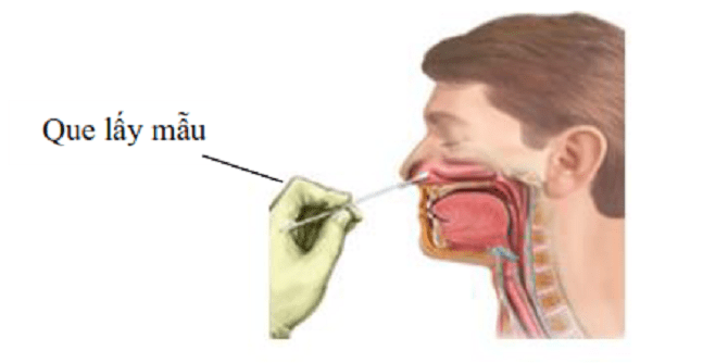 Hướng dẫn sử dụng test nhanh Covid-19 tại nhà