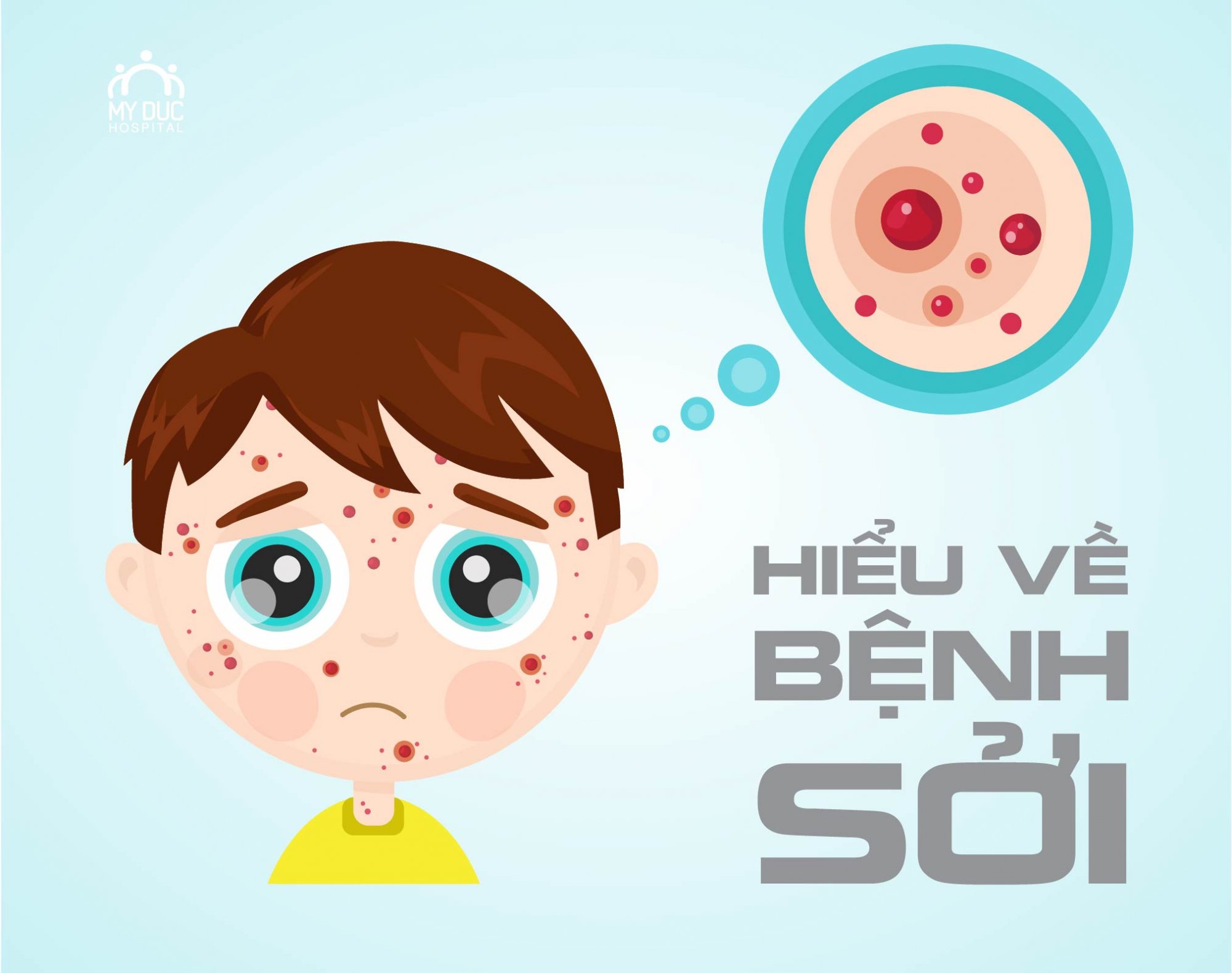 DỊCH SỞI - NGUY CƠ BÙNG PHÁT CAO