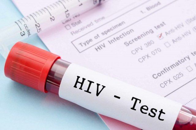 Test nhanh HIV kháng thể ONE STEP (1Hộp=50 que)