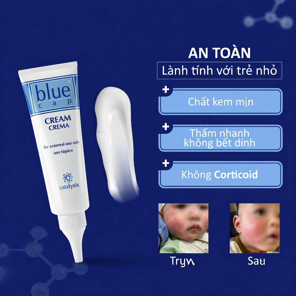 Blue Cap Cream l Kem dưỡng làm dịu, giảm ngứa, mẩn đỏ dành cho da cơ địa, khô, chàm, vảy nến 50G