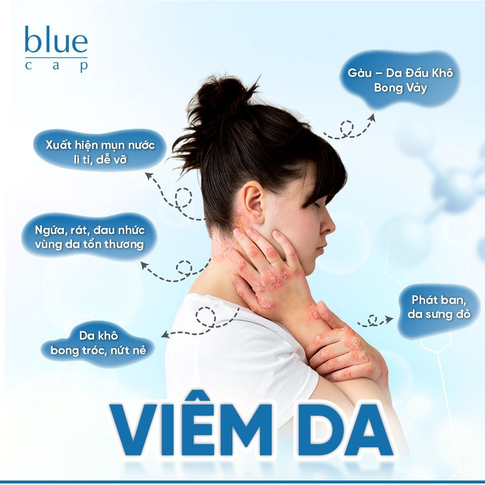 Blue Cap Shampoo l Dầu gội làm sạch bụi bẩn dịu nhẹ giảm ngứa, giảm nhờn cho trẻ em và người lớn