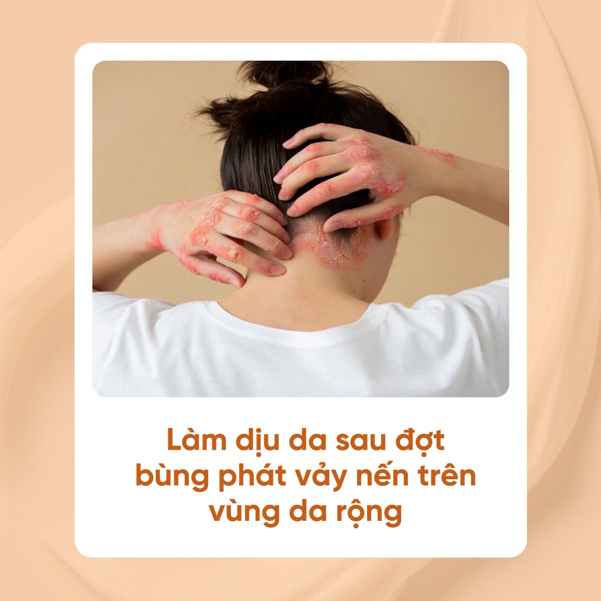 Blue Cap Spray 50ml l Xịt dưỡng ẩm làm dịu da khô, ngứa, bong tróc dành cho trẻ em và người lớn