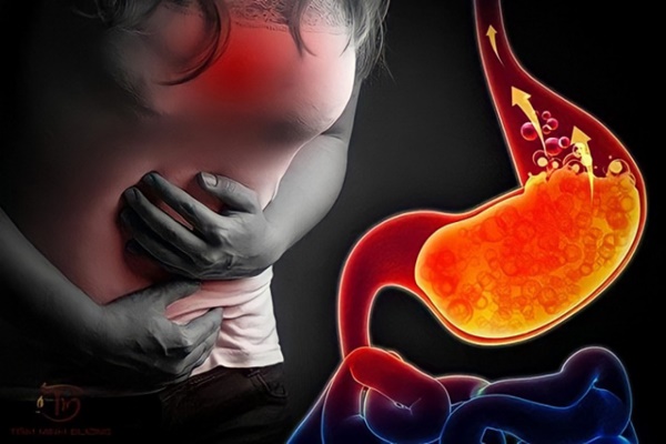 Trào ngược dạ dày: 6 dấu hiệu cảnh báo sớm không nên bỏ qua 