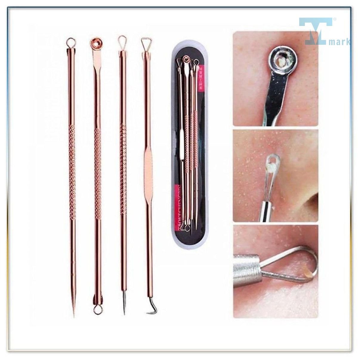Dụng cụ nặn mụn - Cách sử dụng và chăm sóc da hiệu quả