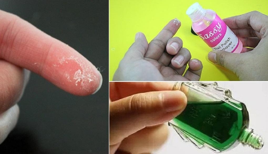 Cách gỡ keo dán sắt đơn giản và hiệu quả nhất