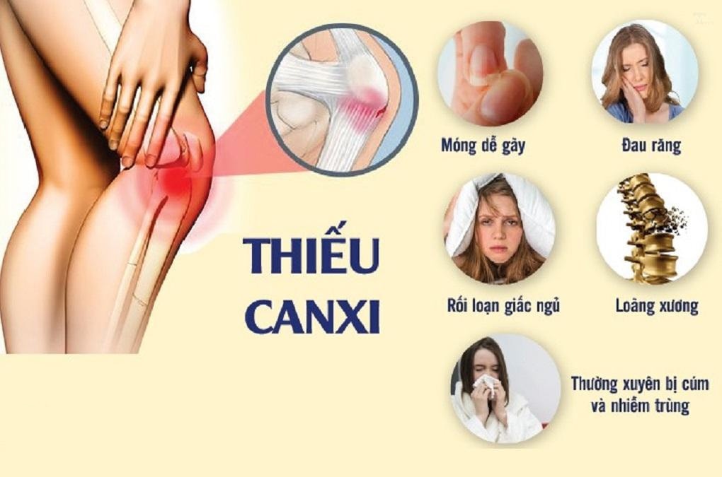 Thiếu canxi - Tầm quan trọng và dấu hiệu cảnh báo | Tmark