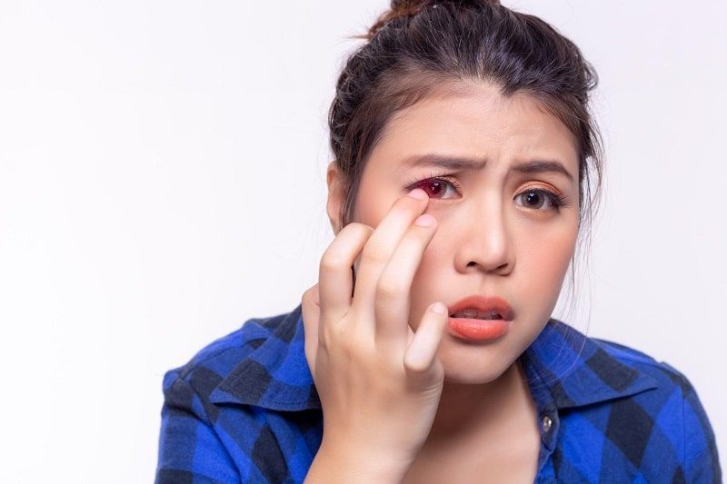 Từ "bốn mắt" tự ti cho đến cô nàng "mắt sáng" rạng ngời nhờ Lens cận thị