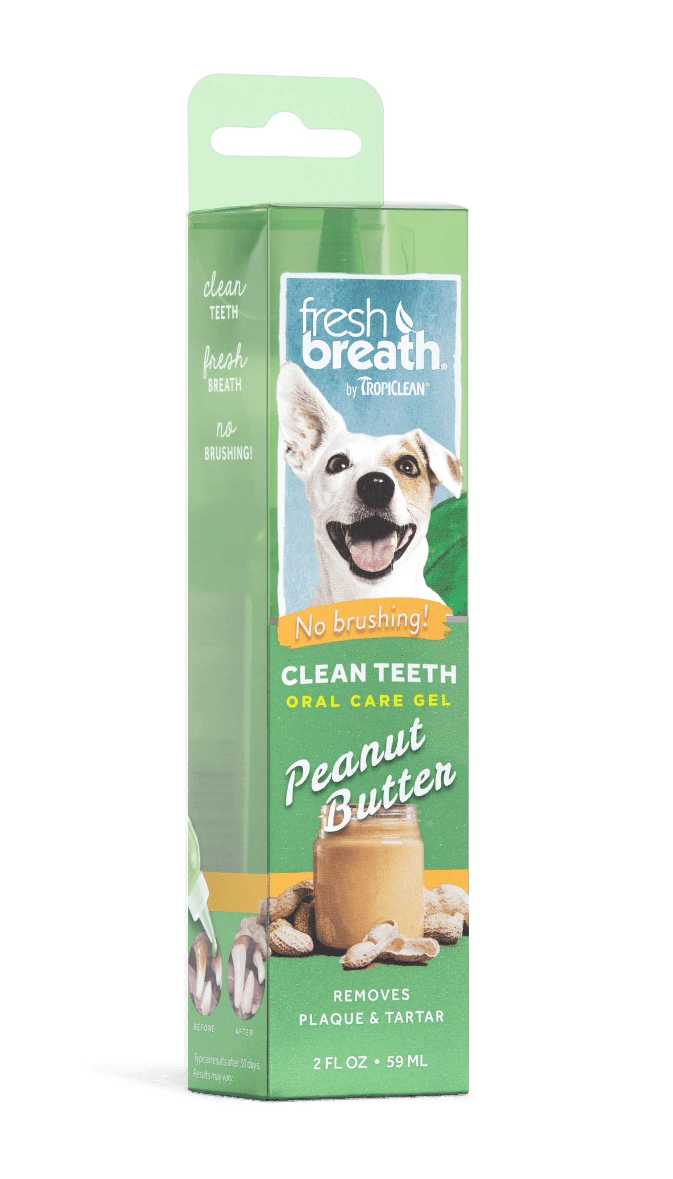 GEL ĐẶC TRỊ MẢNG BÁM CAO RĂNG, VỊ BƠ ĐẬU PHỘNG Fresh Breath Clean Teeth Peanut Butter Fresh Oral Care Gel - 59ml