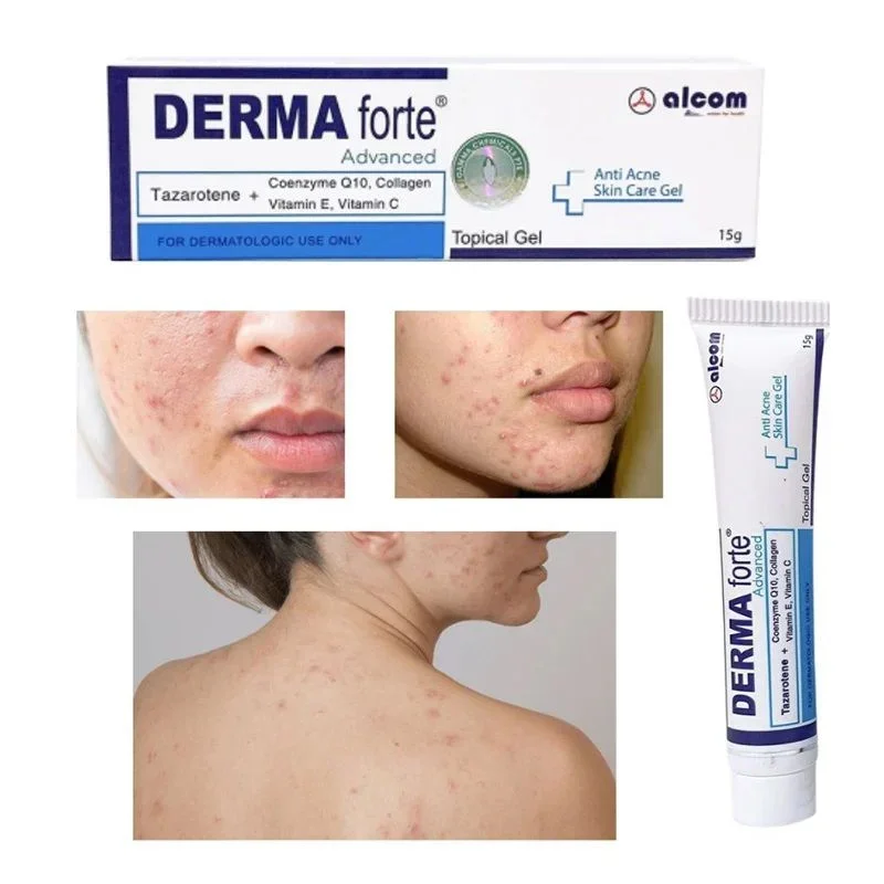 Derma Forte Gel 15g - Giảm Mụn Trứng Cá, Ngừa Thâm, Mờ Sẹo, Dưỡng Da