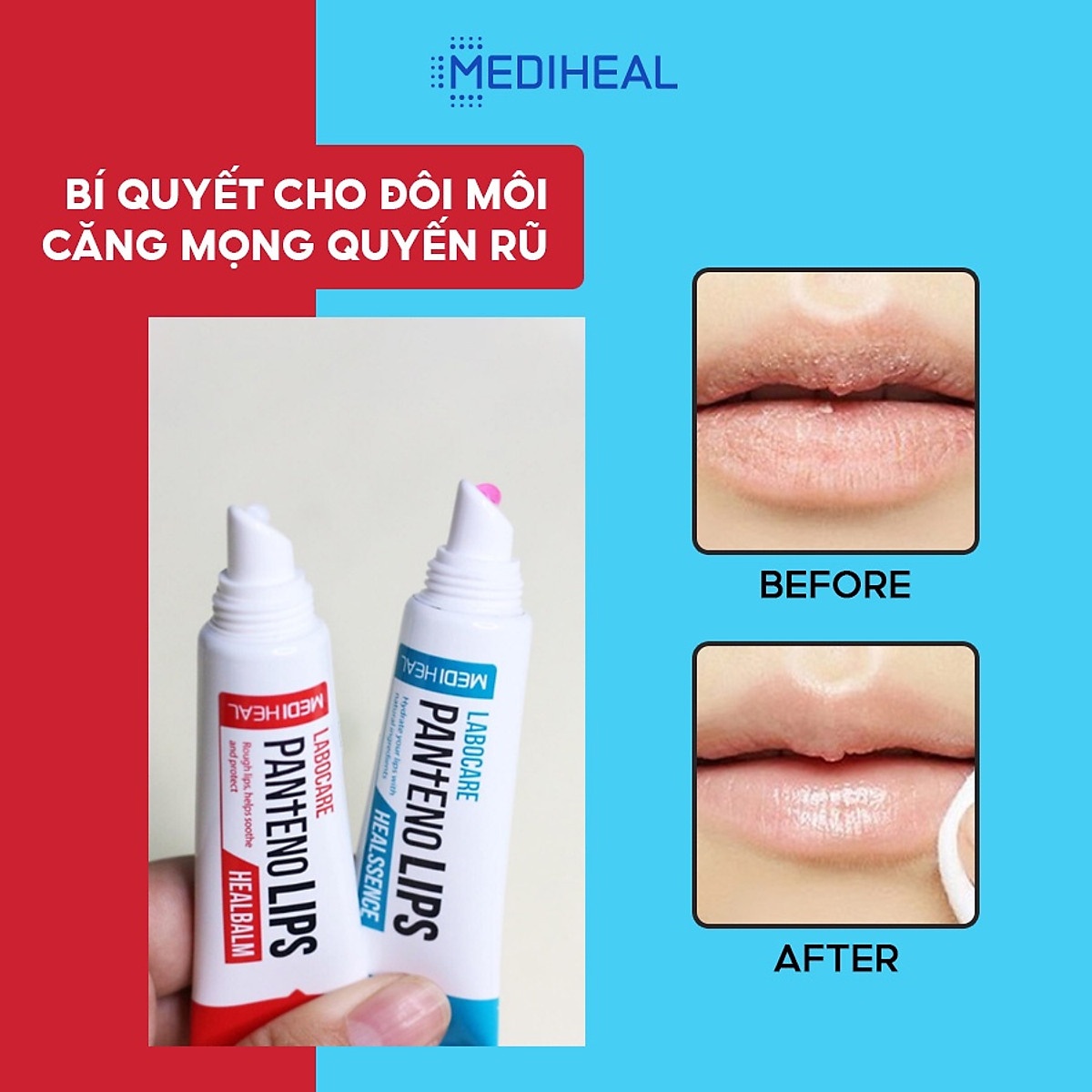 Son Dưỡng Môi Mediheal Labocare Pantenolips 10ml