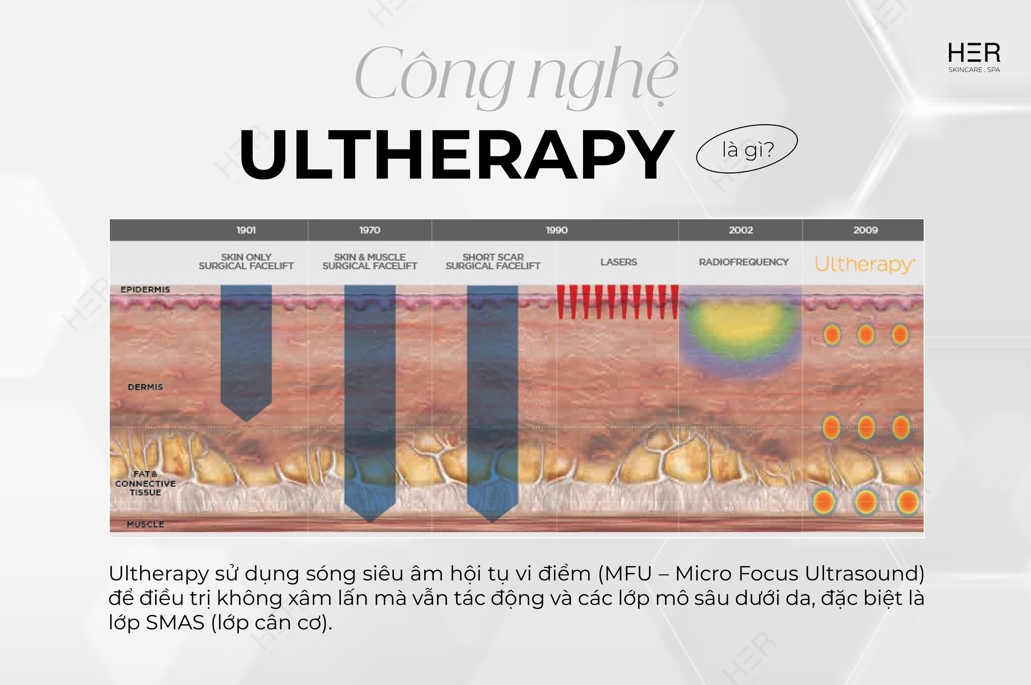 CONG-NGHE-ULTHERAPY-PRIME-THE-HE-MOI-NHAT-2025-TAI-HER-SKINCARE-amp-SPA-1.jpg