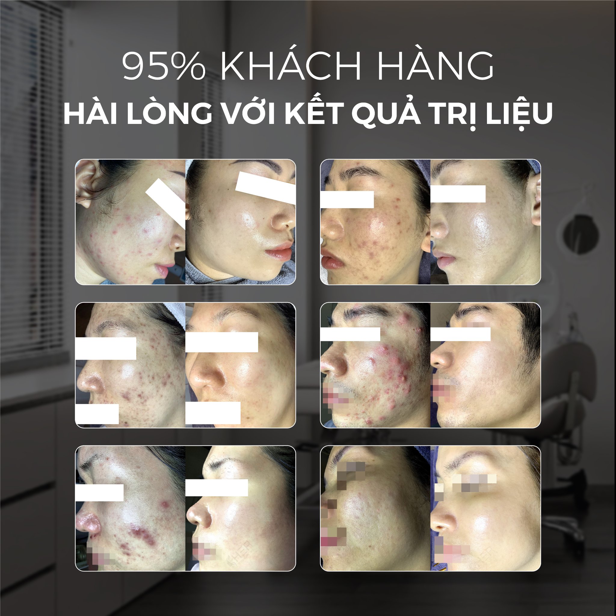 HER-SPA-CLINIC-TU-VAN-TRI-LIEU-DA-CHUYEN-NGHIEP-1.jpg