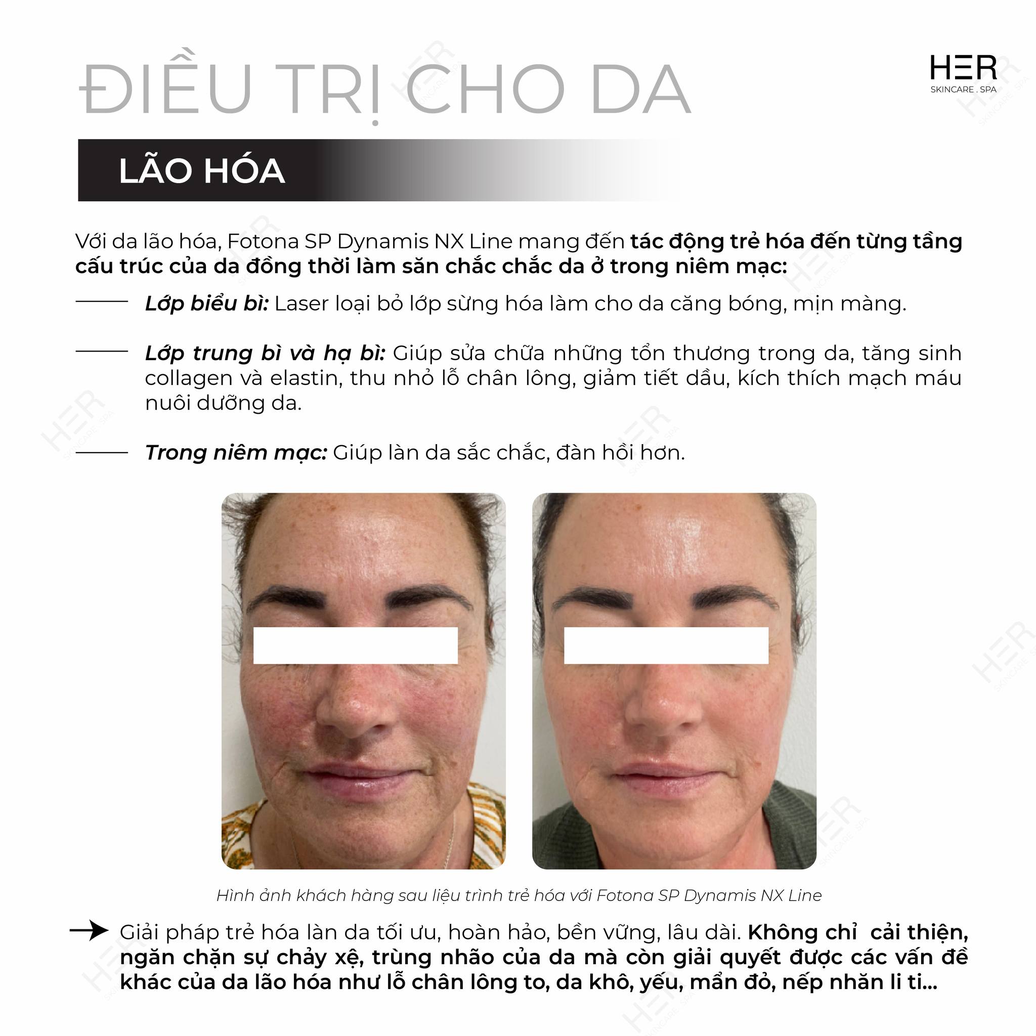 LASER-FOTONA-MO-RA-KY-NGUYEN-MOI-TRONG-DIEU-TRI-12.jpg