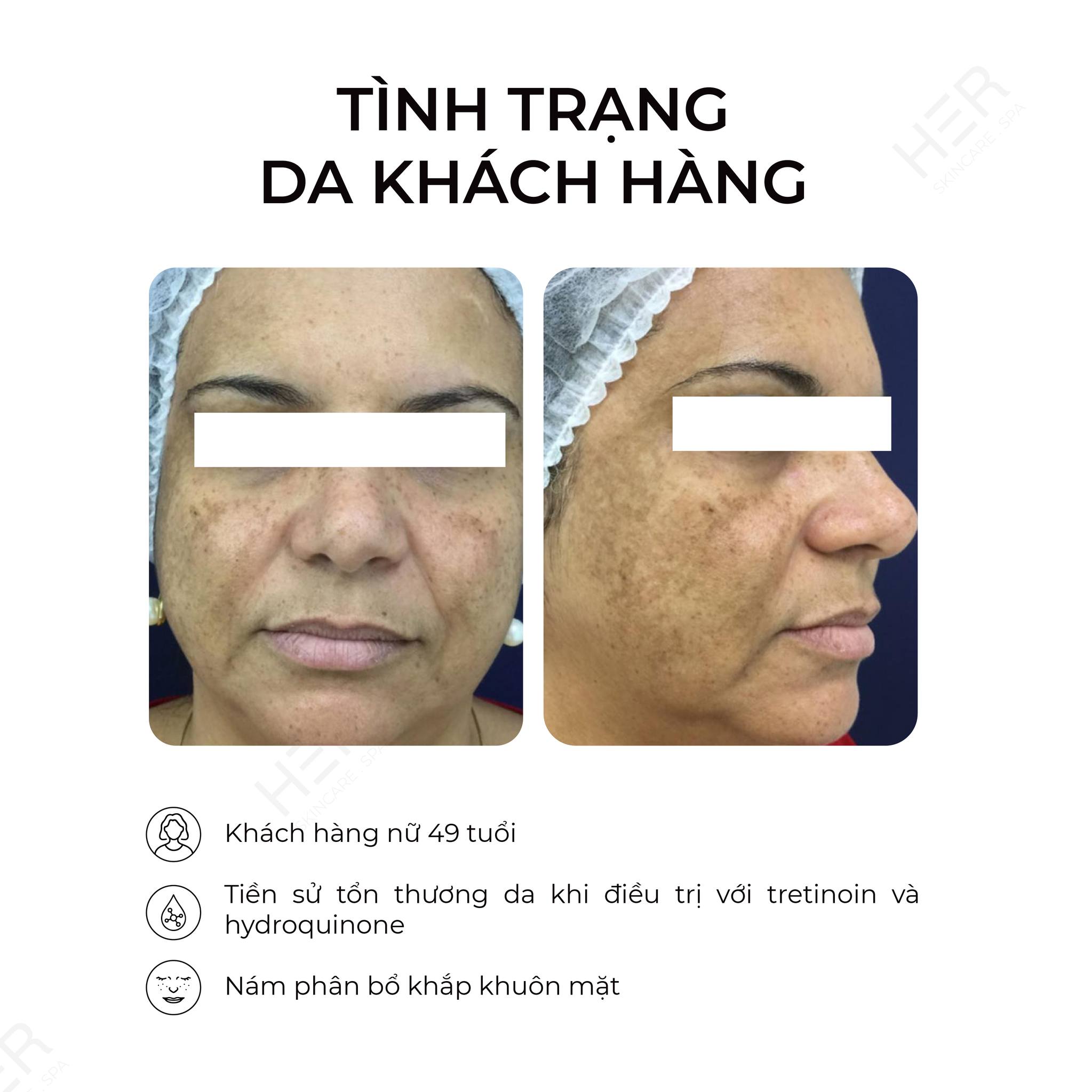 LASER-FOTONA-MO-RA-KY-NGUYEN-MOI-TRONG-DIEU-TRI-4.jpg