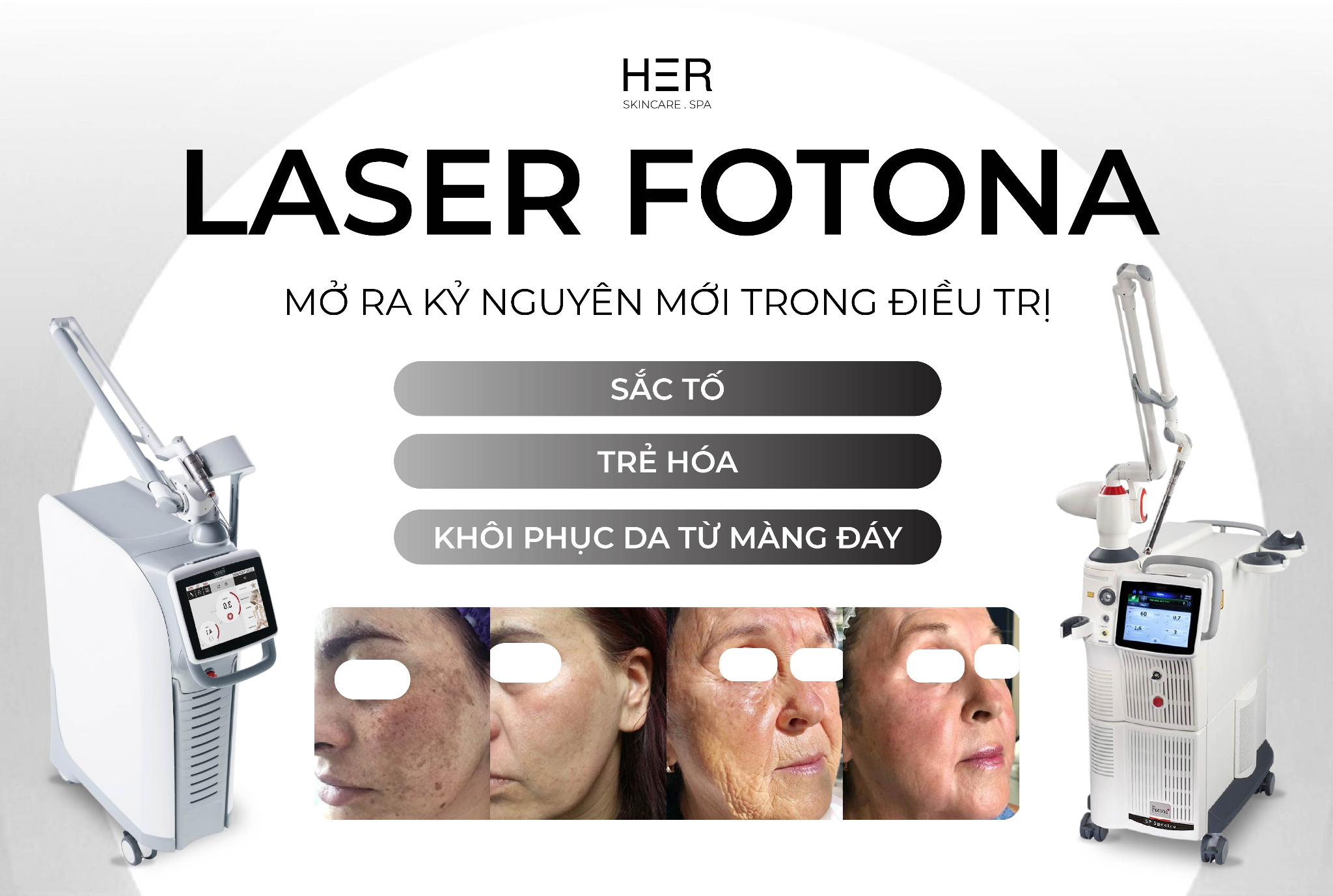 LASER FOTONA - MỞ RA KỶ NGUYÊN MỚI TRONG ĐIỀU TRỊ