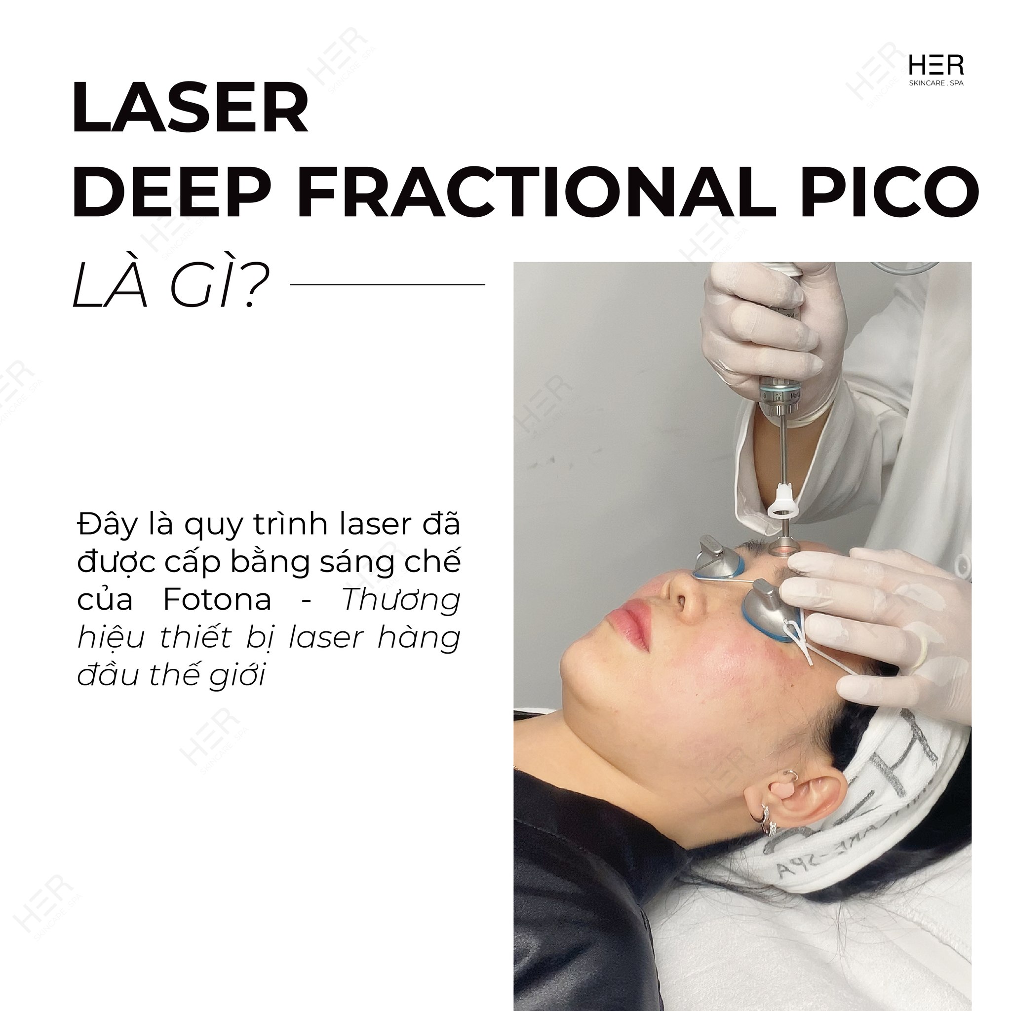 DEEP-SO-GLOW-DINH-CAO-CONG-NGHE-LASER-PICO-TAI-TAO-DA-DA-TANG-3.jpg