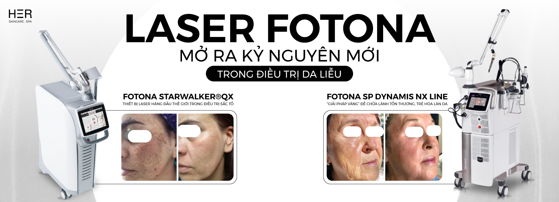 Fotona