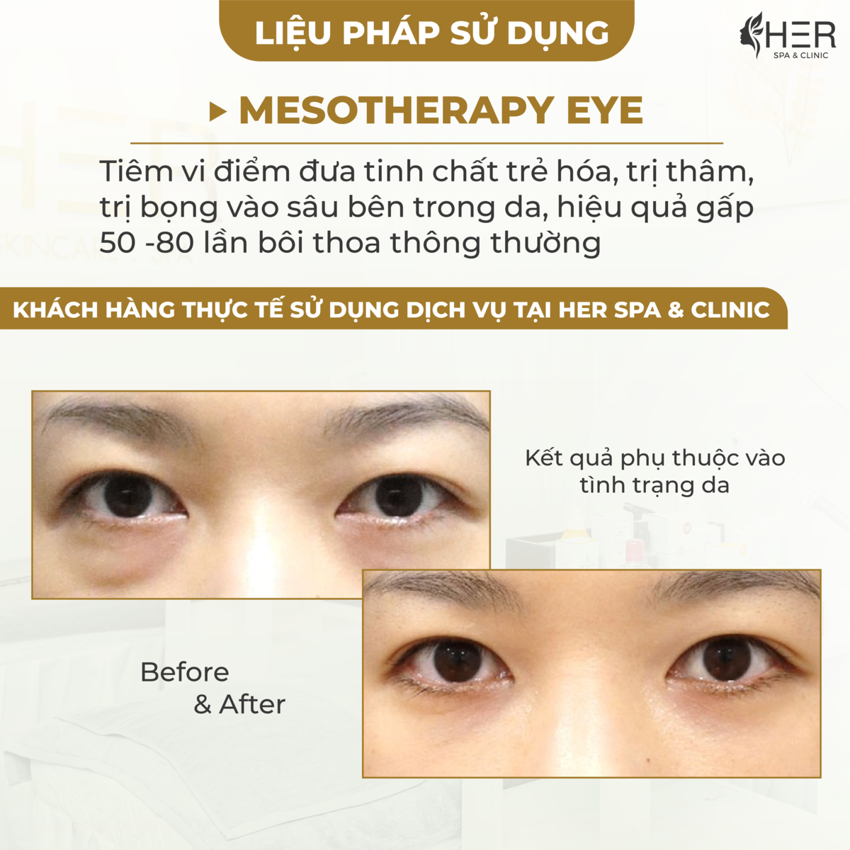 Căng Bóng | Eye | Sáng da - giảm nhăn