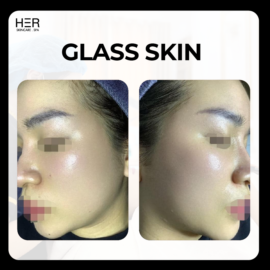 Glass Skin - Loại bỏ sừng hoá, sạch sâu lỗ chân lông, căng bóng cấp ẩm tức thì