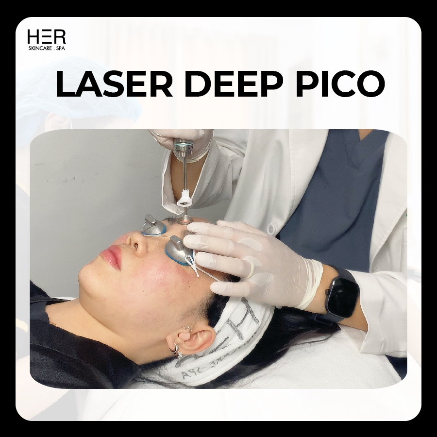 Laser Deep Fractional