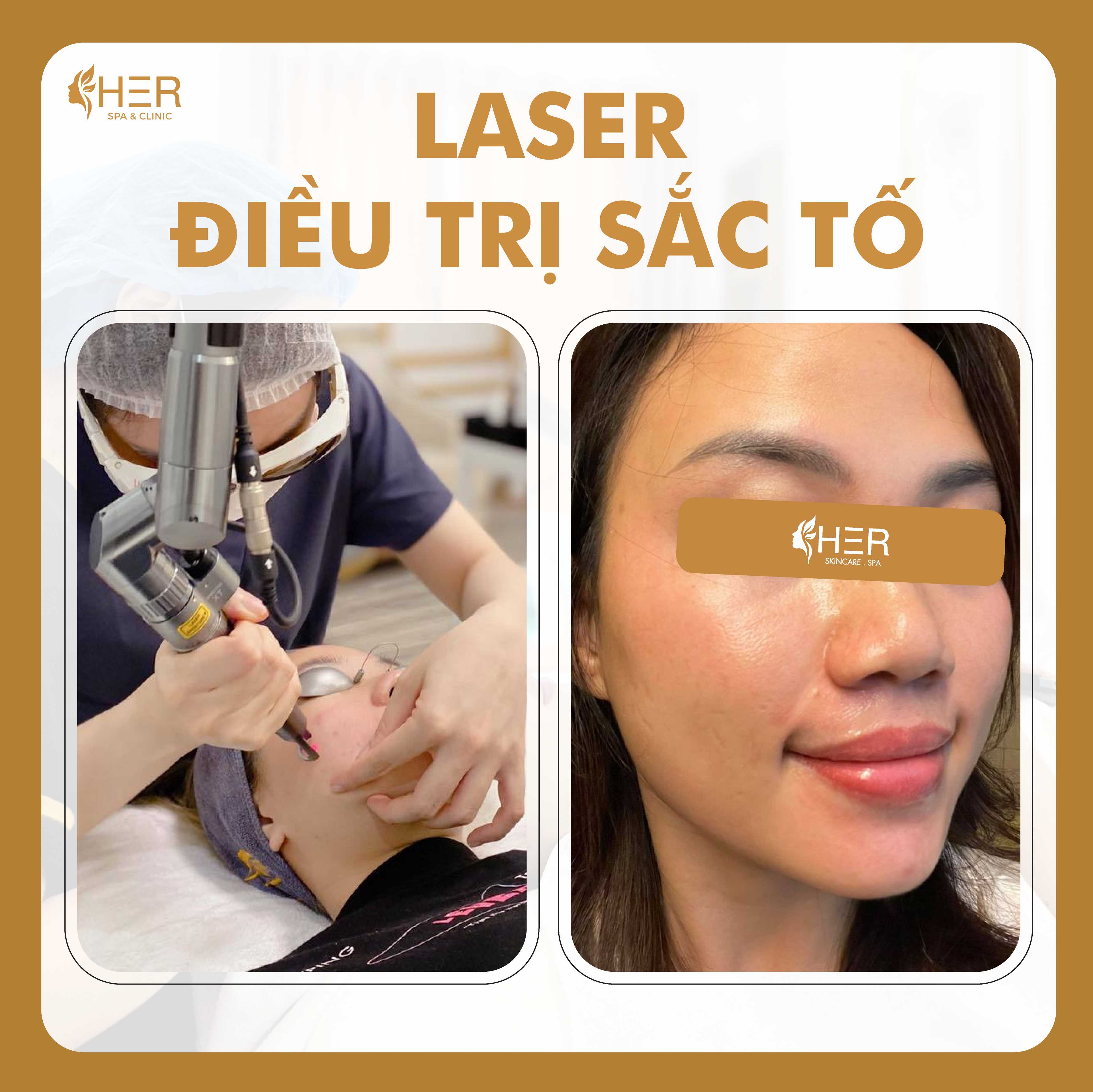 Laser Toning - Sáng da căng bóng