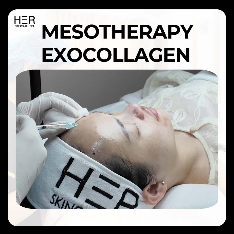 Căng Bóng | Exocollagen
