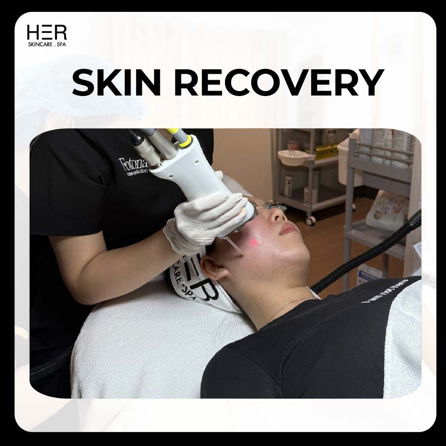 Skin Recovery By Fotona Dynamis - Trẻ hoá & Phục hồi da mẫn cảm