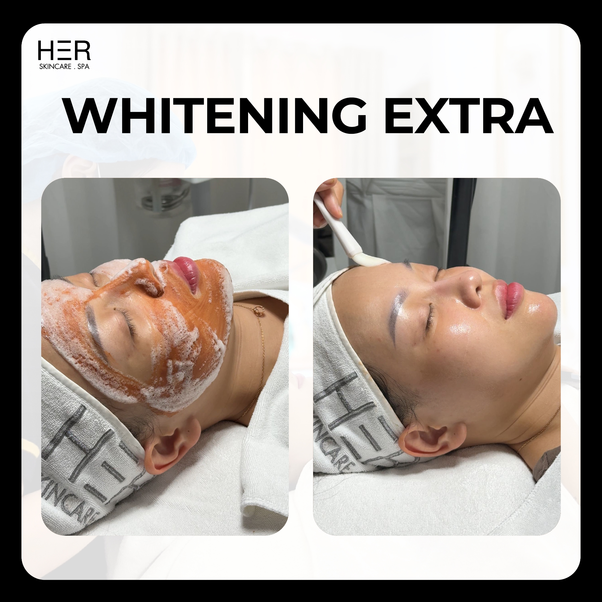 Whitening Extra - Làm sáng da với công nghệ Oxygen