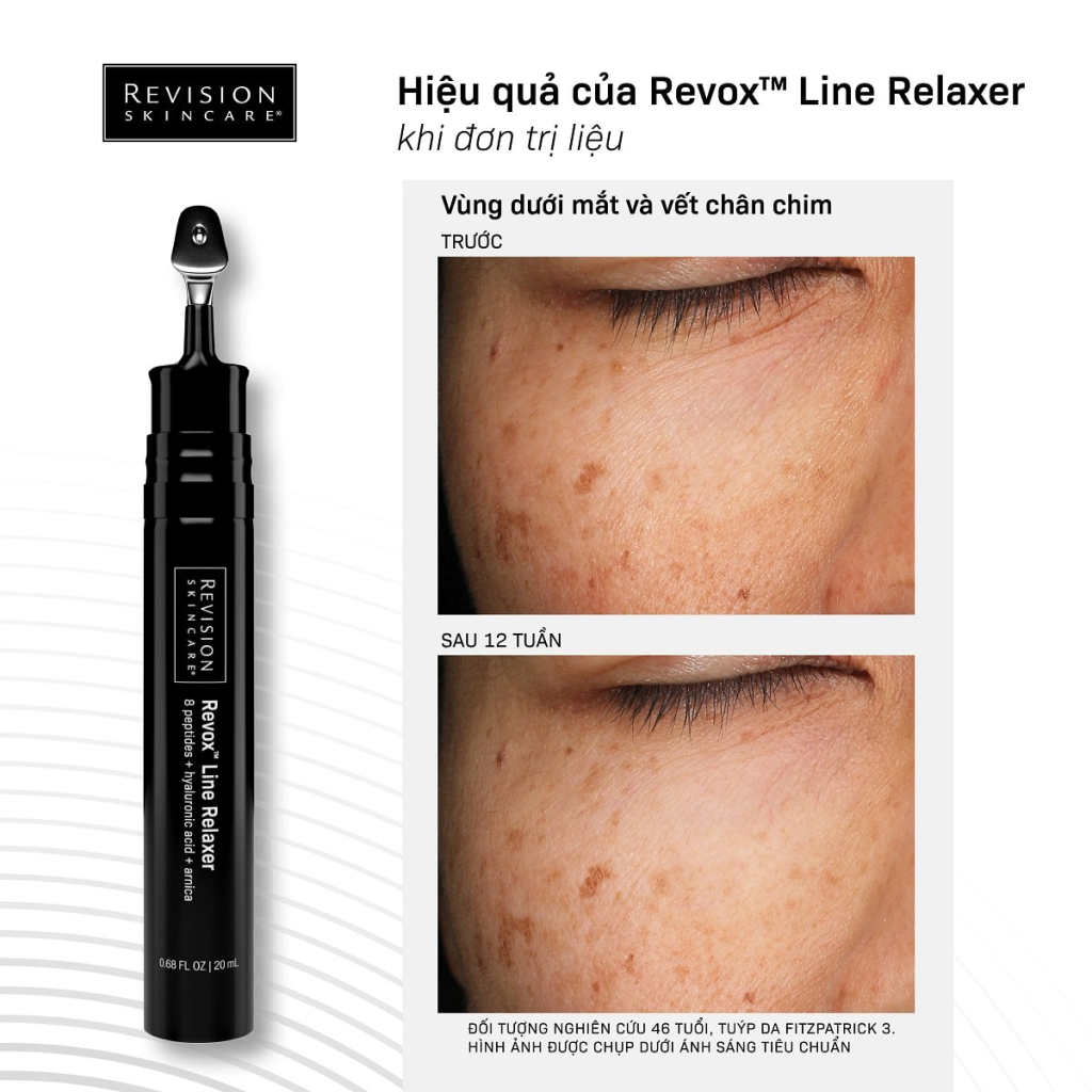 Serum-duong-da-Revision-Skincare-Relox-Line-Relaxer-20ml-R-HSD-4-28--3.png?v=1780723218