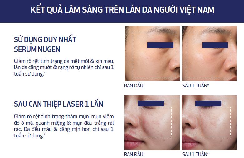 Serum-tre-hoa-da-cap-do-te-bao-Obagi-Nu-Gen-30ml-R-HSD-10-29-.jpg?v=1774414889