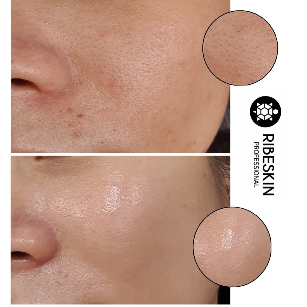 Mặt nạ phục hồi và dưỡng ẩm EP+ After Care Booster Mask 25 miếng
