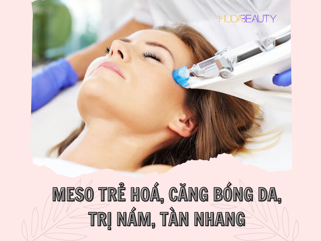 Meso trẻ hoá, căng bóng da, trị nám