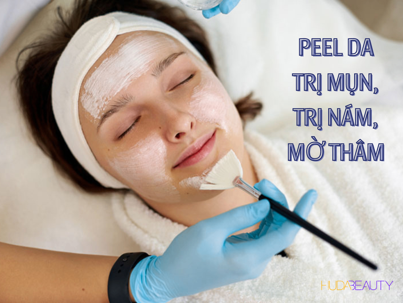 Peel da trị mụn, trị nám, mờ thâm