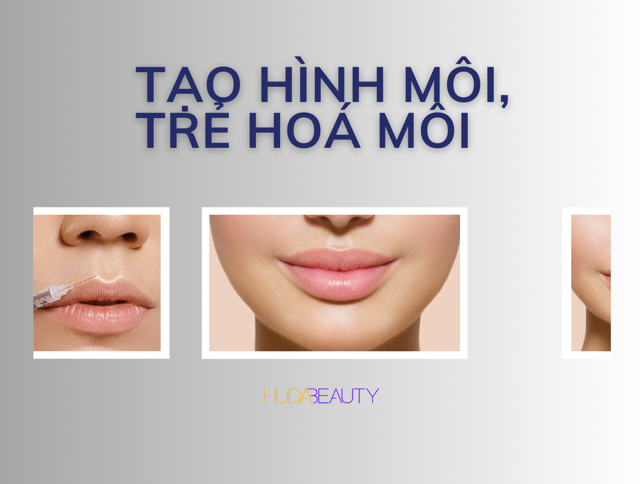 Tạo hình môi Baby, làm đầy môi