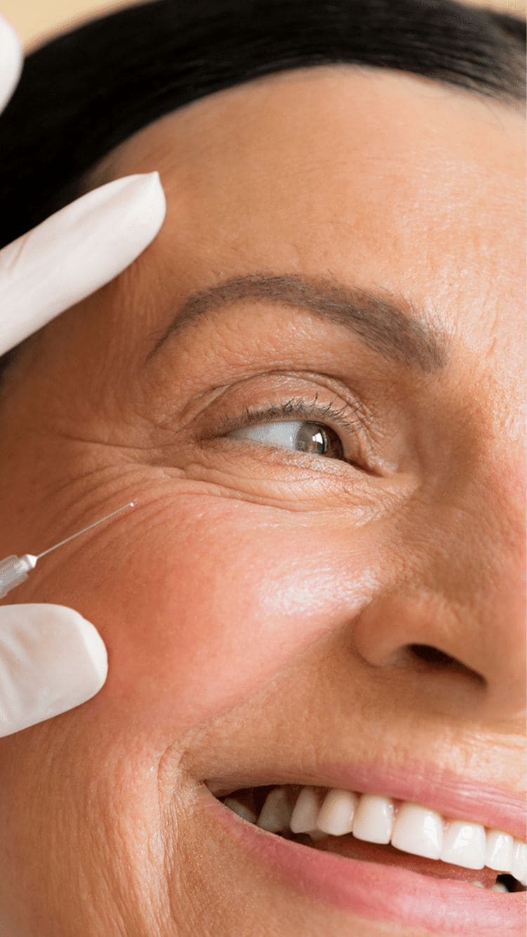 Chong-Lao-Hoa-Da-Vung-Mat-Quang-Tham-Nep-Nhan-Da-Chung_Khi nào cần can thiệp thẩm mỹ nhẹ (filler, laser, PRP, meso) (1).jpg
