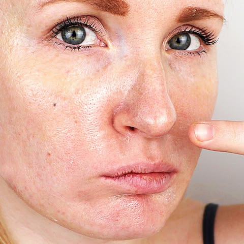 Da Dầu Và Da Nhờn Có Giống Nhau Không? Cách Phân Biệt Chính Xác