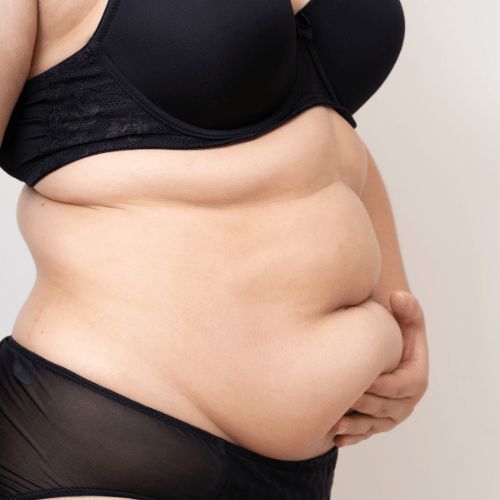 Giảm mỡ có giảm cân không? Sự thật gây bất ngờ