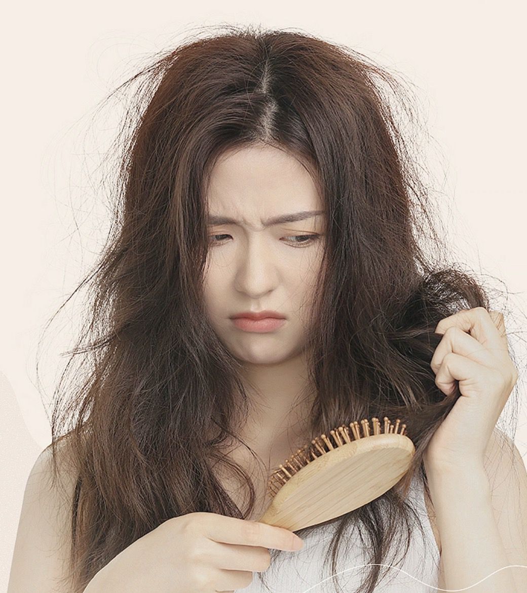 Rụng Tóc Do Stress
