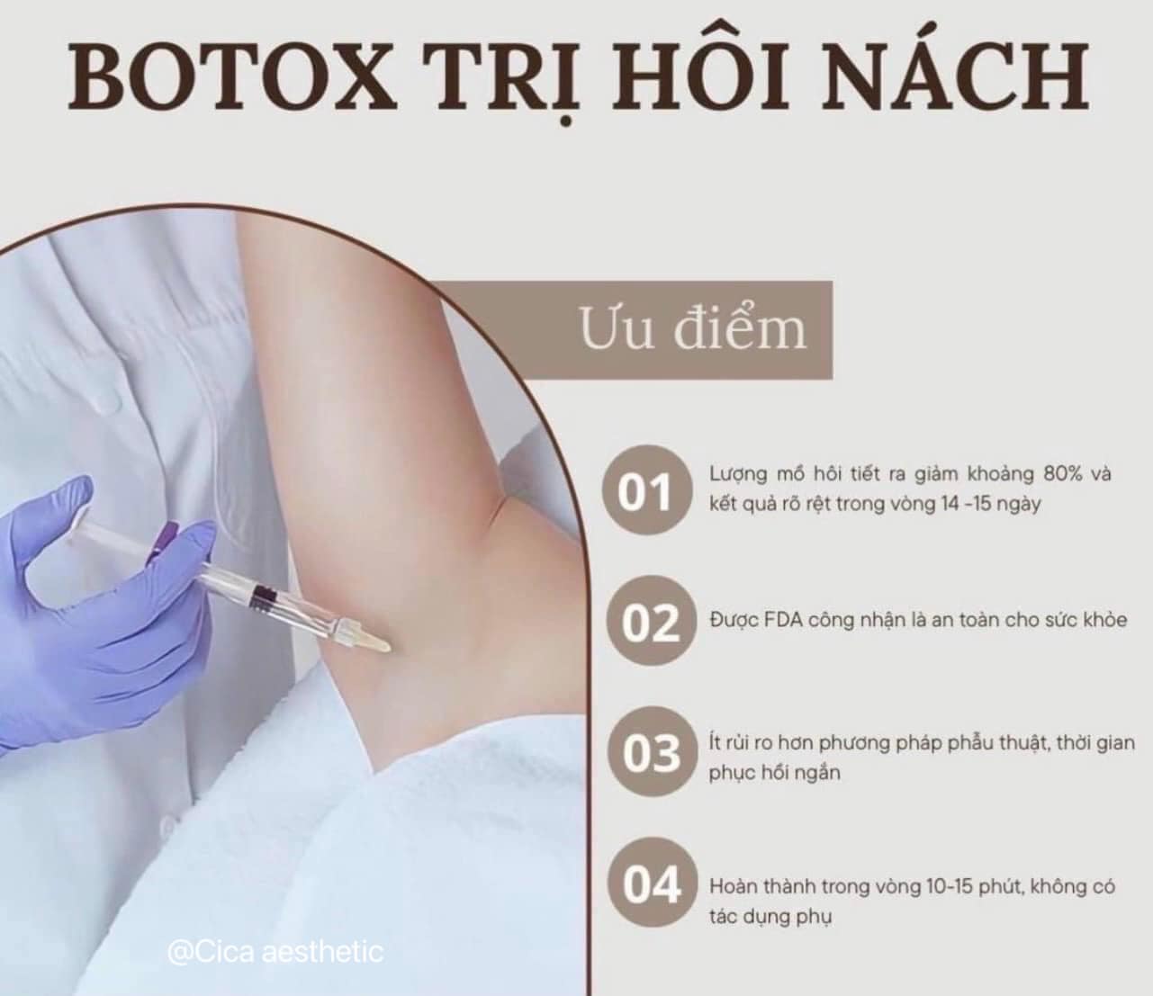 Tiem-Botox-Nach-Xong-Co-Ra-Mo-Hoi-Nua-Khong-_Tiêm Botox Nách Xong Có Ra Mồ Hôi Nữa Không.jpg