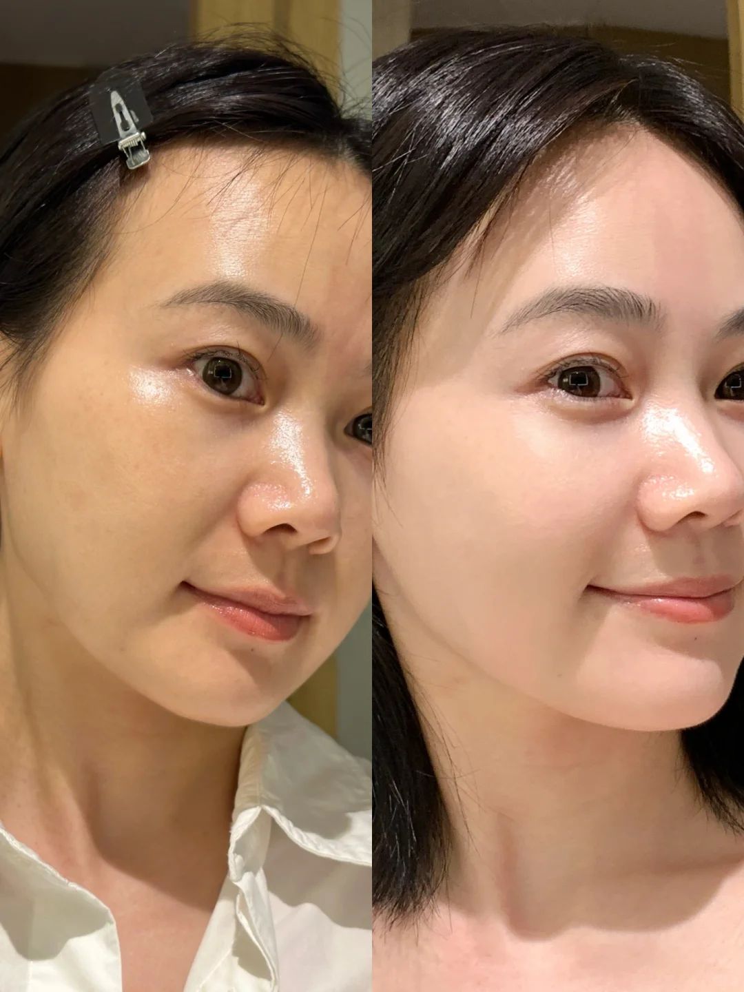 Tri-Tham-Co-Can-Can-Thiep-Cong-Nghe-Khong-_Trị Thâm Có Cần Can Thiệp Công Nghệ Không 2.jpg