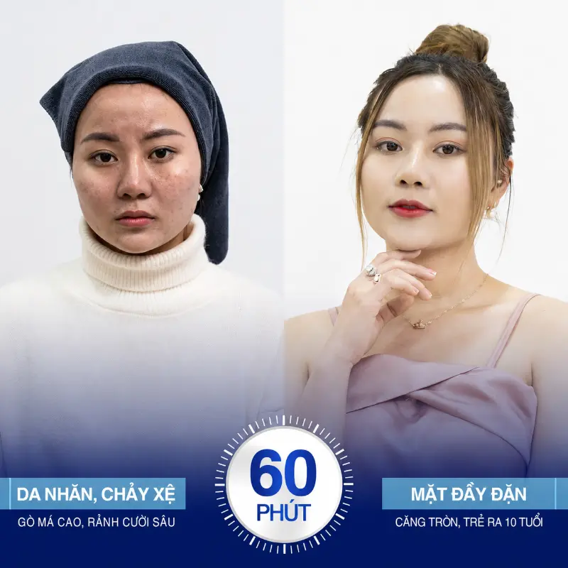 Cang-Chi-Co-Lam-Mat-Bi-Lech-Khong--2.webp