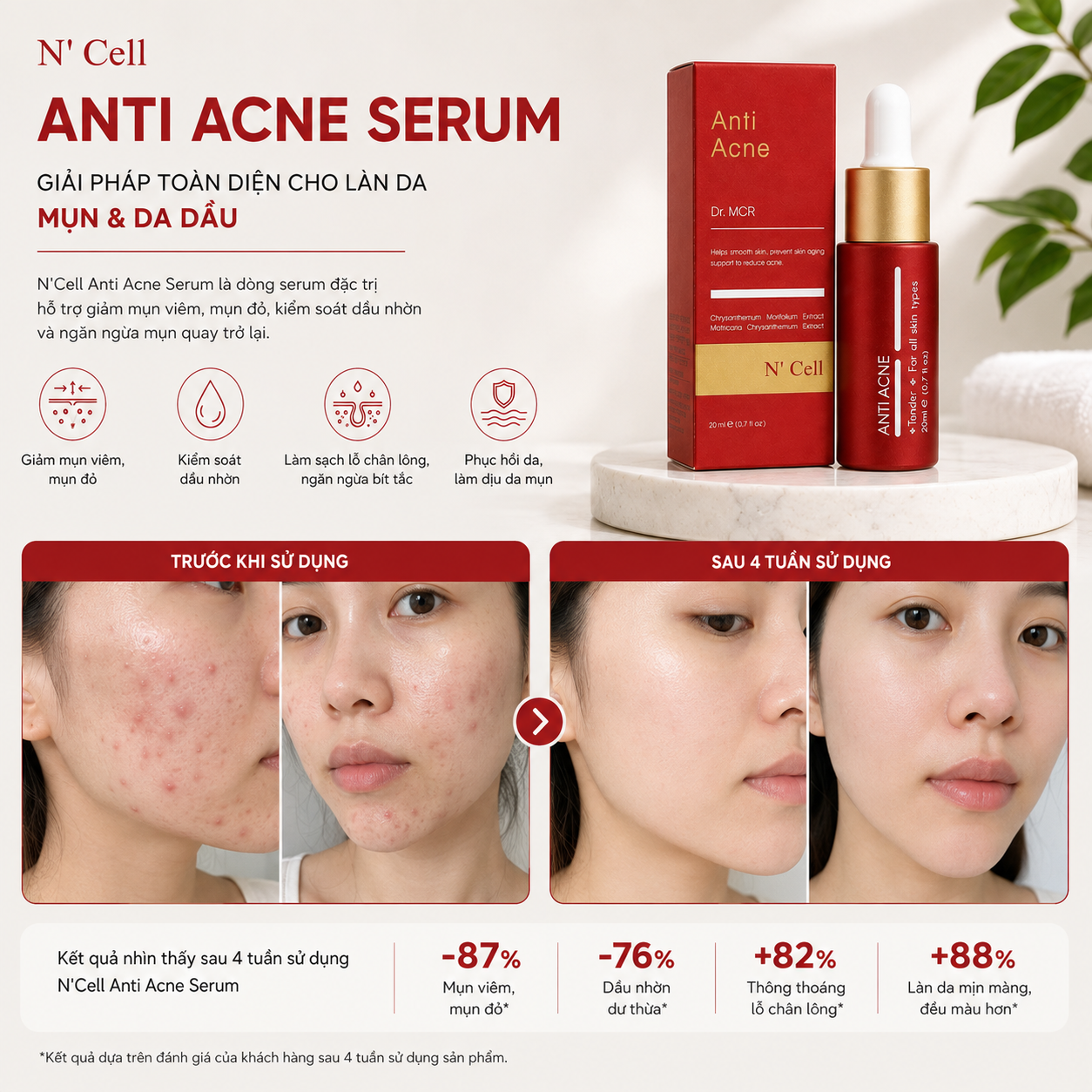 N'Cell Anti Acne Serum 20ml 4.png