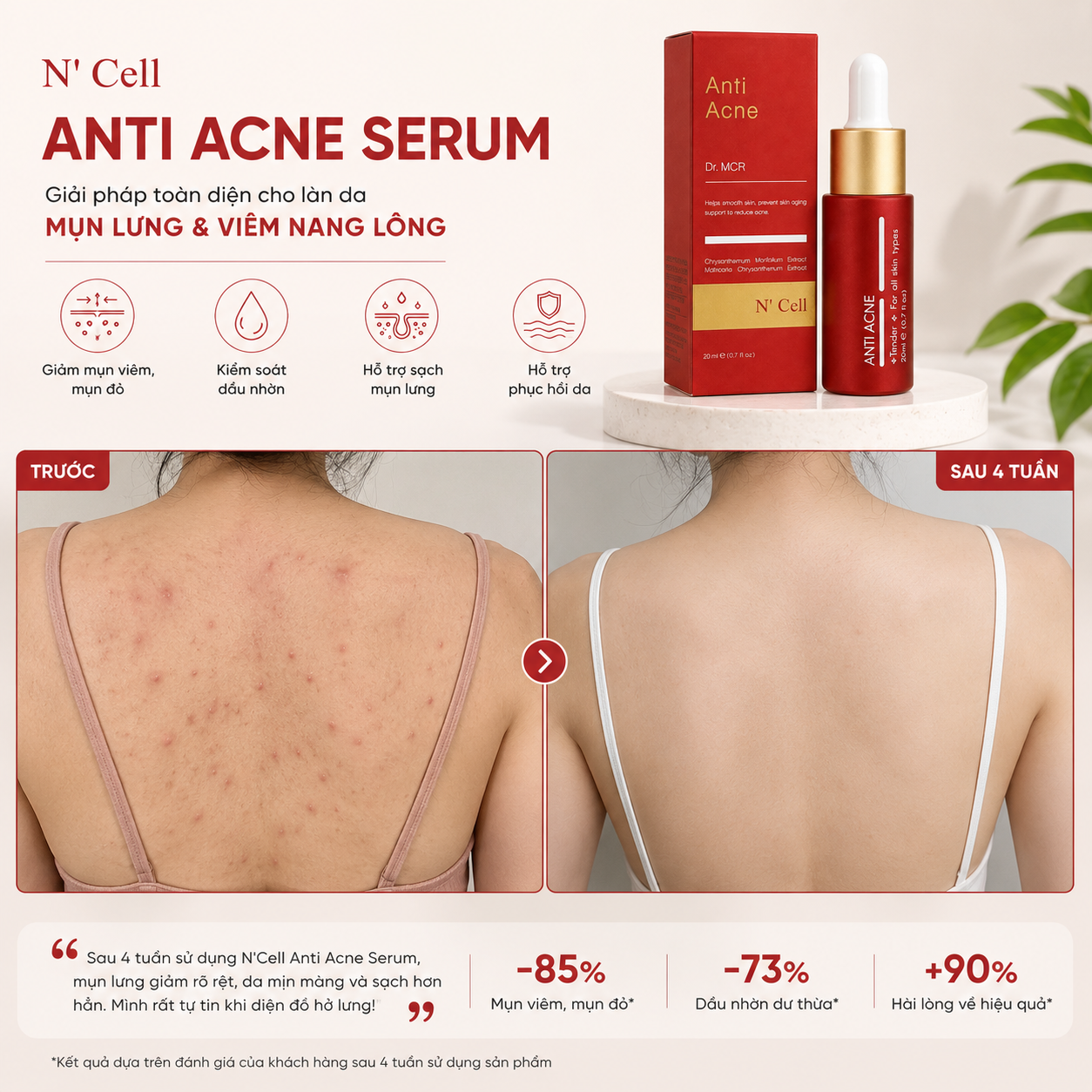 N'Cell Anti Acne Serum 20ml 3.png