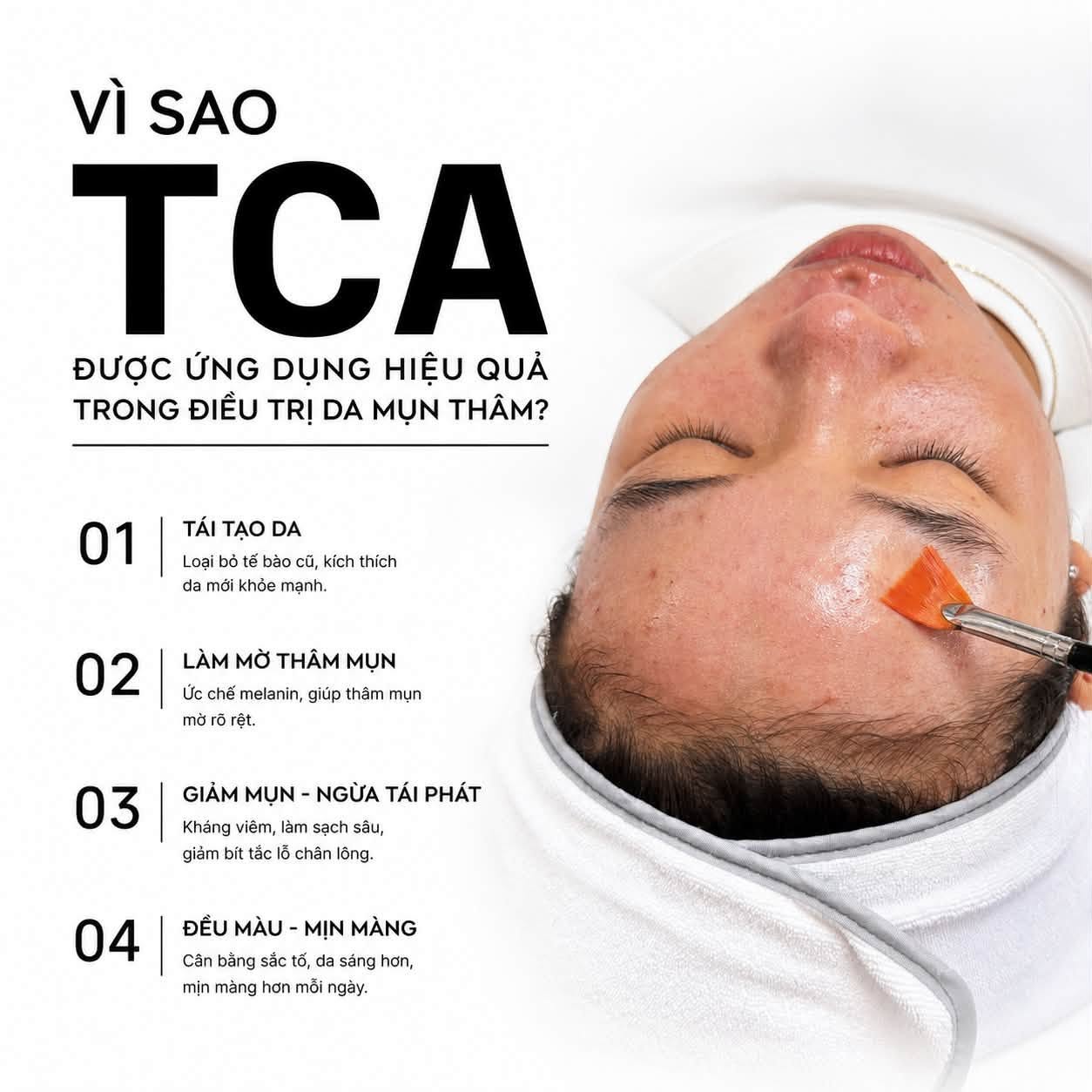 Peel TCA Là Gì. Và Những Điều Bạn Cần Biết.jpg