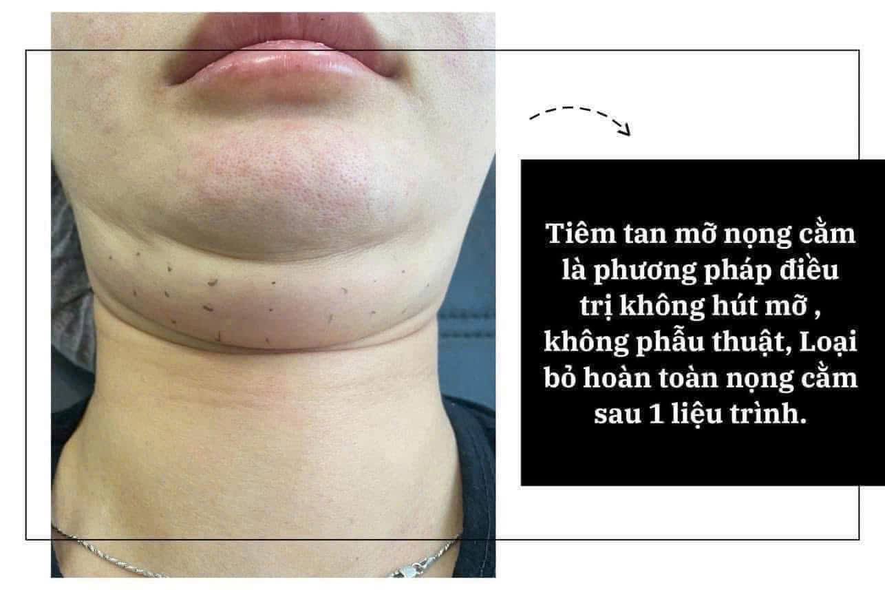 Review-Lri-Vline-for-Face-Tiem-thai-mo-mat-amp-cam-2.jpg