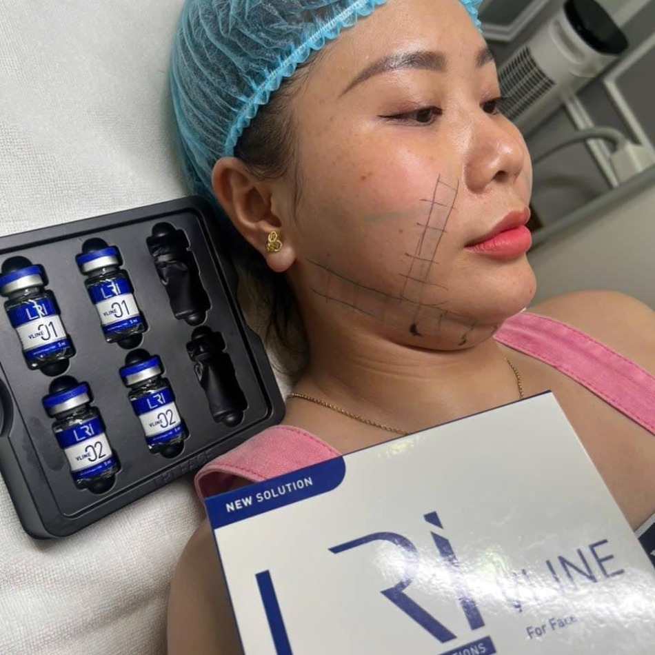 Review-Lri-Vline-for-Face-Tiem-thai-mo-mat-amp-cam.jpg