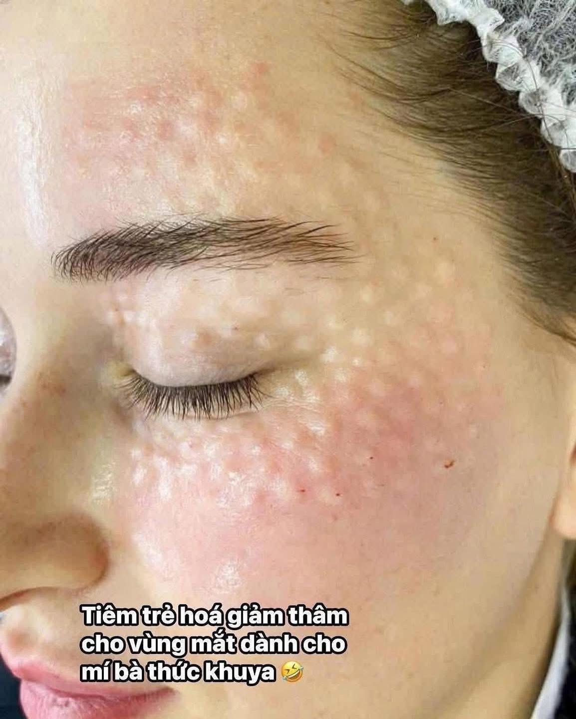 Tham-Mat-Nang-Hom-Mat-Sau-Phai-Lam-Sao--2.jpg