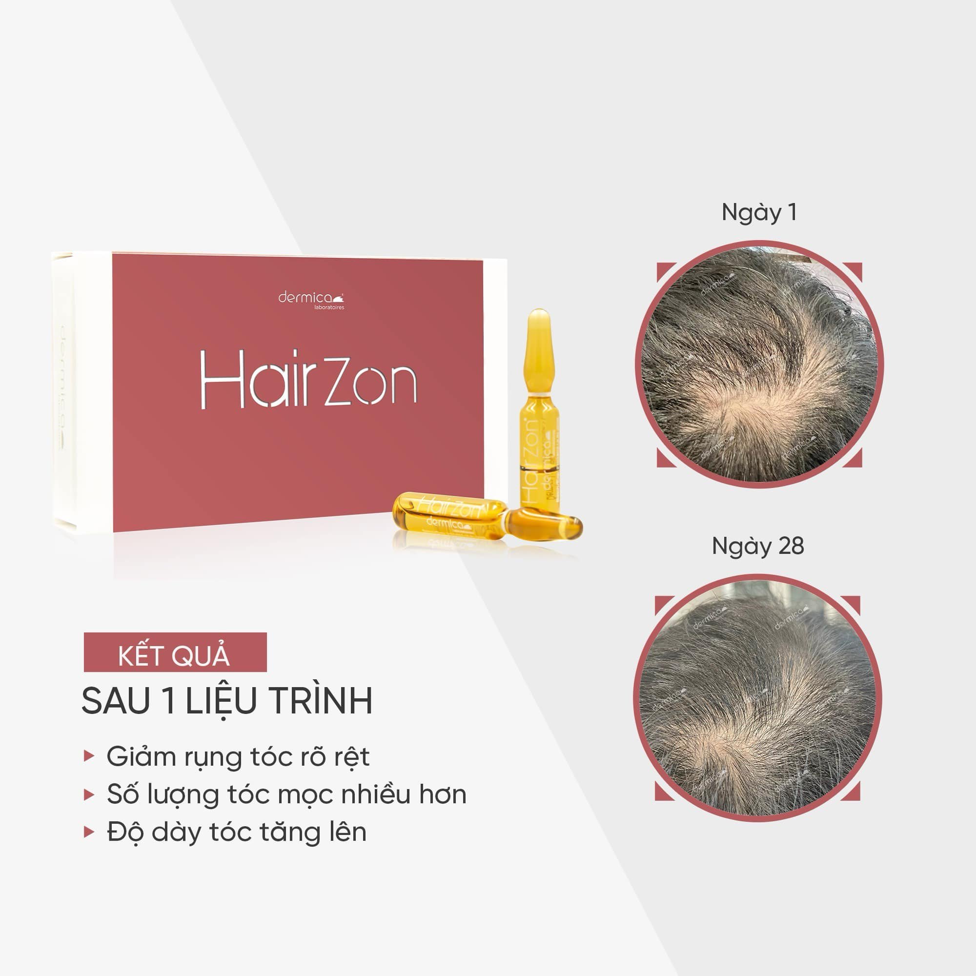 Hairzon - Huyết thanh kích thích mọc tóc, giảm gãy rụng Hộp 10 ống x 2ml