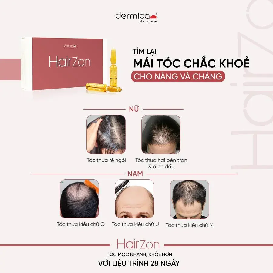 Hairzon - Huyết thanh kích thích mọc tóc, giảm gãy rụng Hộp 10 ống x 2ml